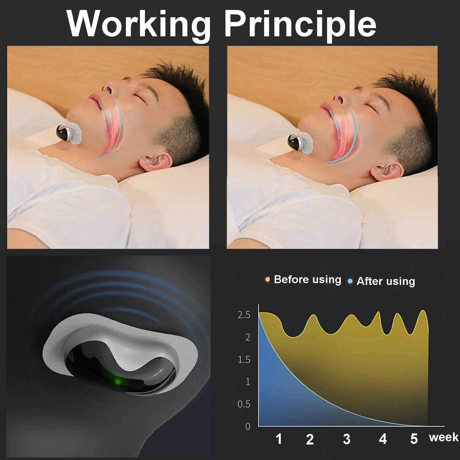 Dispositivo Antirronquidos Inteligente,Dispositivo de Parada de ronquidos CPAP, solución de ronquidos,Dispositivos Seguros y cómodos para roncar, 6 Niveles de Ajuste de Intensidad