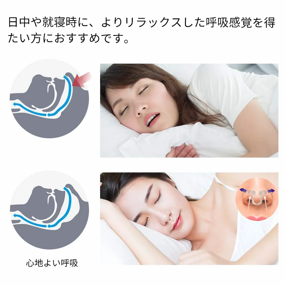 WoodyKnows Dilatador Nasal Super-Support XS 4 Piezas